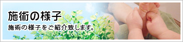 施術の様子