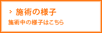 施術の様子